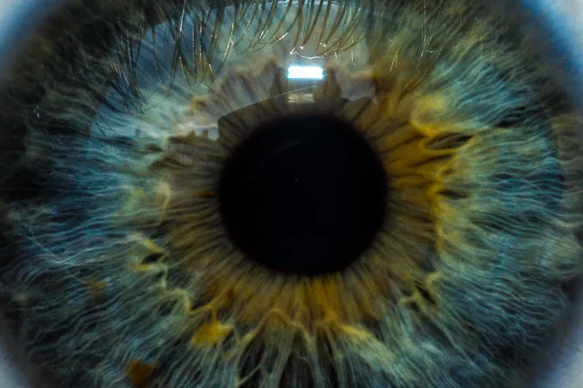 Eye